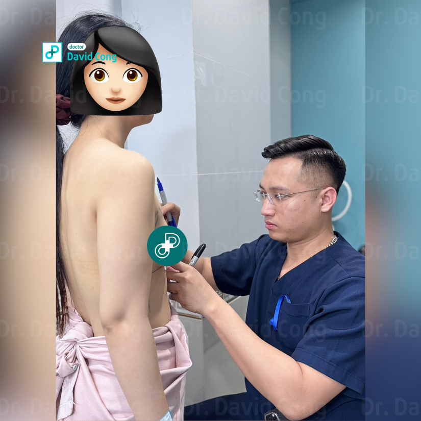 before and after breast augmentation at dr david cong