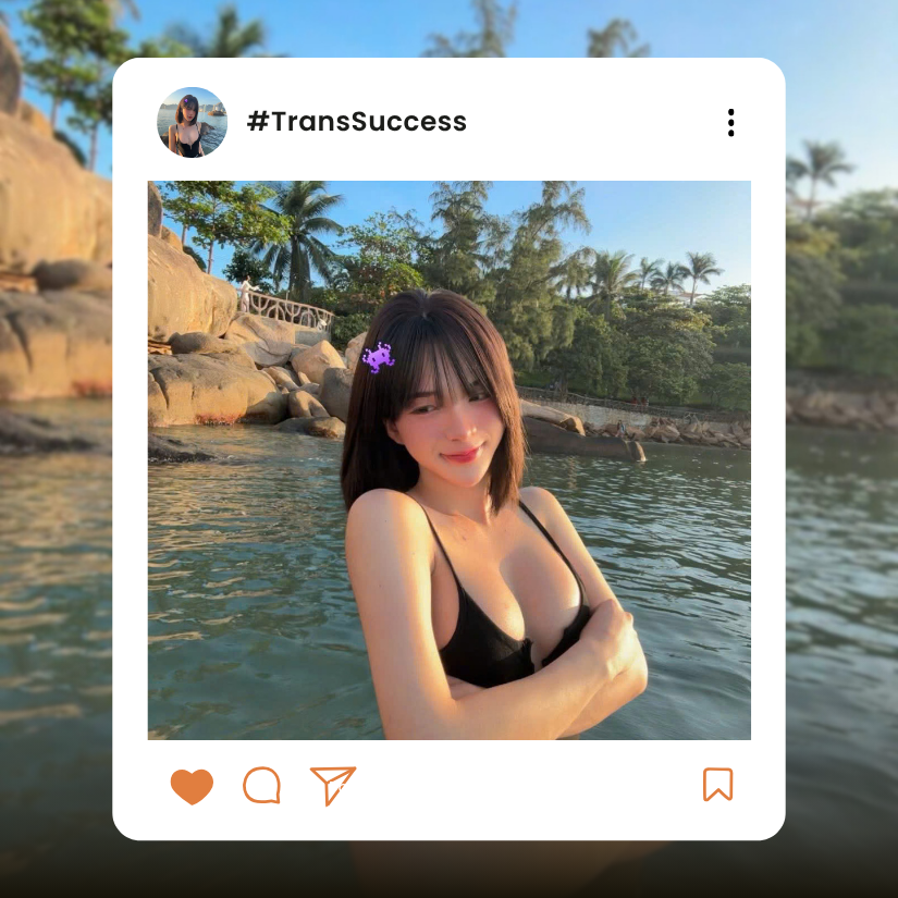 before and after breast augmentation at dr david cong