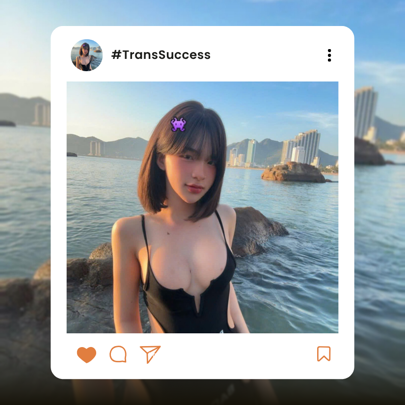 before and after breast augmentation at dr david cong