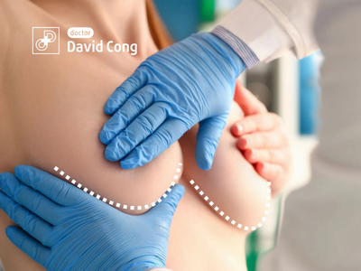 Modern breast augmentation photos at Dr. David Cong 