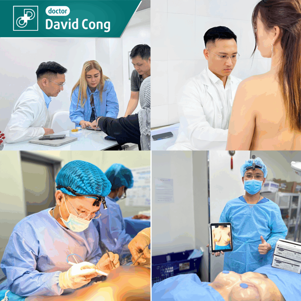 breast augmentation procedure at dr david cong
