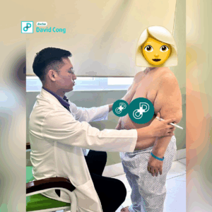 before liposuction procedure dr david-cong