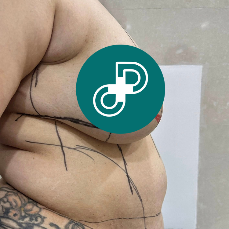 mommy makeover at Dr David Cong