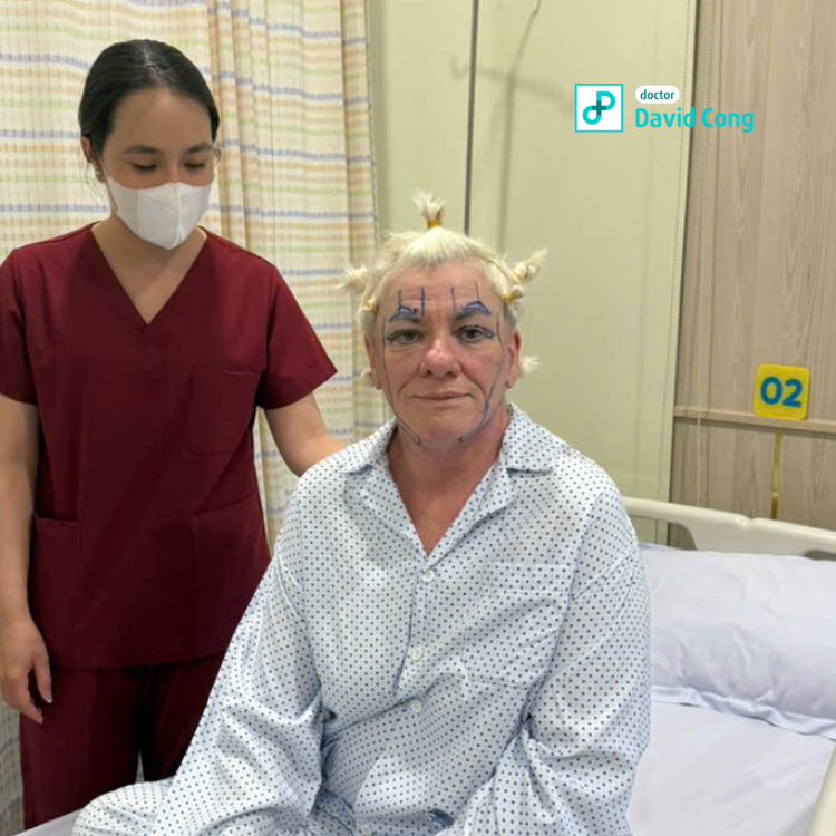 before facelift at dr david cong