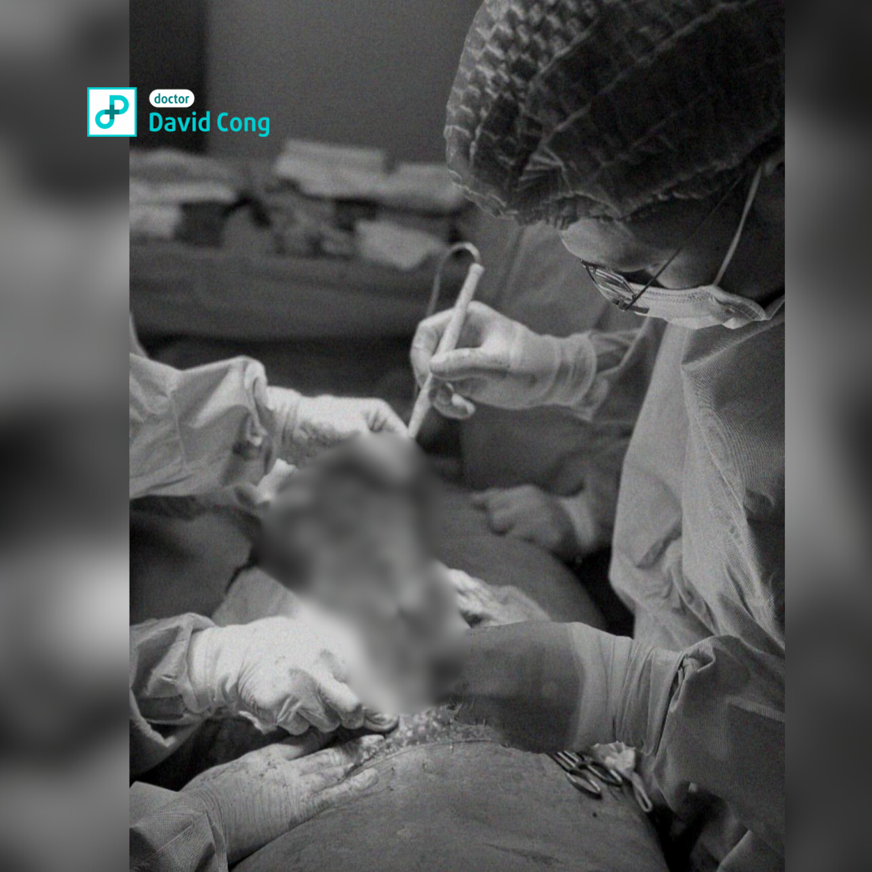 tummy tuck procedure dr david-cong